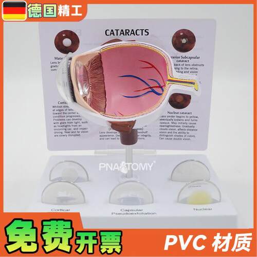 德国】眼球模型病理眼球演示教具眼科F展示礼品人体器官解剖模型