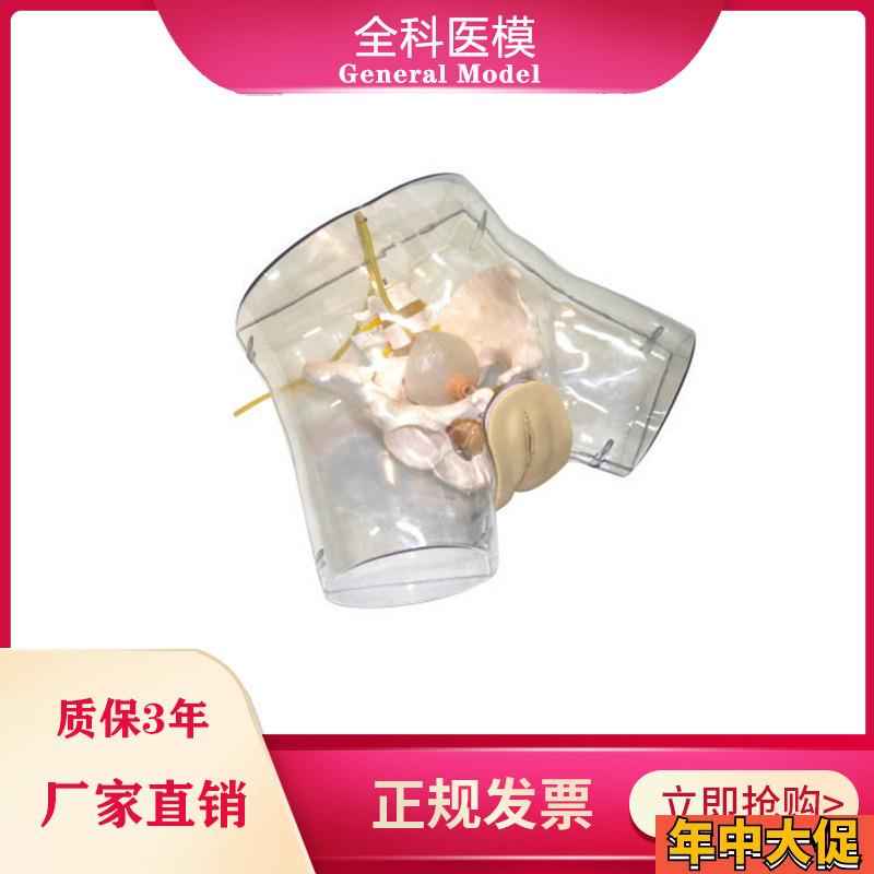 透明刮宫模型护理导尿人工流产妇科A阴部内部解剖观察模型GM/FT32
