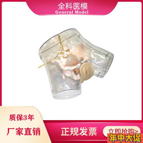 透明刮宫模型护理导尿人工流产妇科A阴部内部解剖观察模型GM/FT32