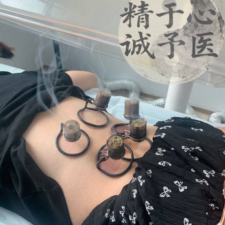 温针灸固定器温针灸防落灰器艾灸神器针灸工具艾灸防落灰工具艾柱