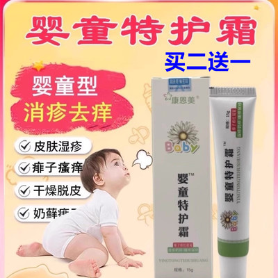 奇力康洋甘菊婴童特护霜湿疹痱子