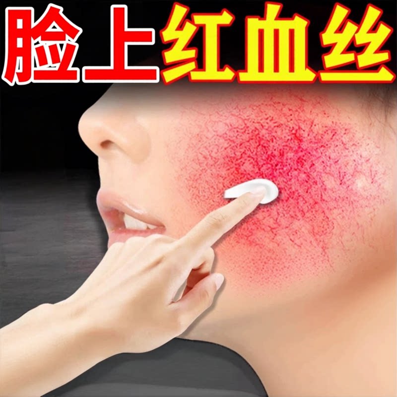 去脸上红血丝修复角质层改善敏感肌肤增厚除脸部上泛红修复霜膏药