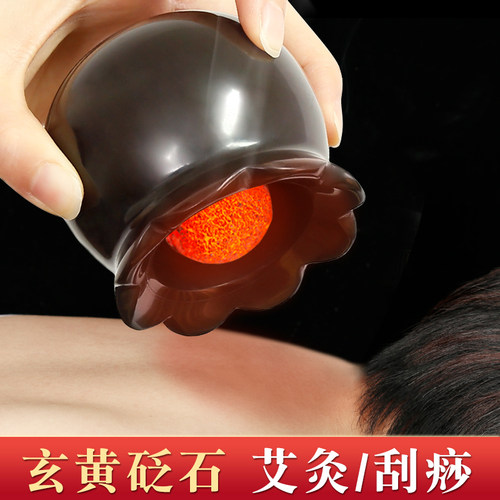 砭石火龙罐莲花口大号防烫家用美容院中医推拿艾灸刮痧一体艾灸罐