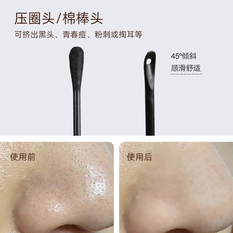 。粉刺挤压器一次性闭口圈粉刺针小针头专用清痘针挤压圈黑头挤压