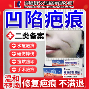 凹陷性疤痕修复凝胶可搭生长因子填充祛痘坑除疤膏水痘官方正品MY