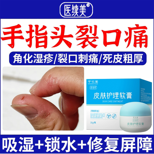 手指头裂口干裂修复霜愈合防裂膏手足干裂皲裂凡士林角化型湿疹ON