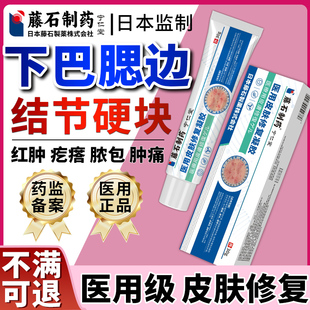 下巴痤疮结节硬块痘反复长痘囊肿腮边淋巴痘疖肿脸用疙瘩脓包MY
