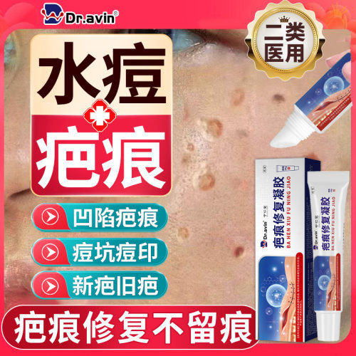 【医用正品】疤痕修复凝胶