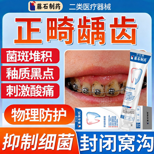 正畸防蛀牙龋齿修复非牙膏含氟去黑线牙菌斑清理儿童护齿疼养龈FF