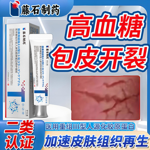 男性阴茎龟头包皮系带撕裂裂口开裂发炎水肿修复龟头炎红肿烂BF