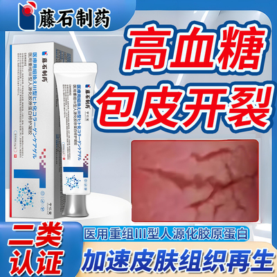 包皮系带反复裂口，久经不愈