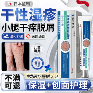 干性湿疹小腿部秋冬天季止皮肤干燥瘙痒性儿童顽固皮炎外专用膏MY