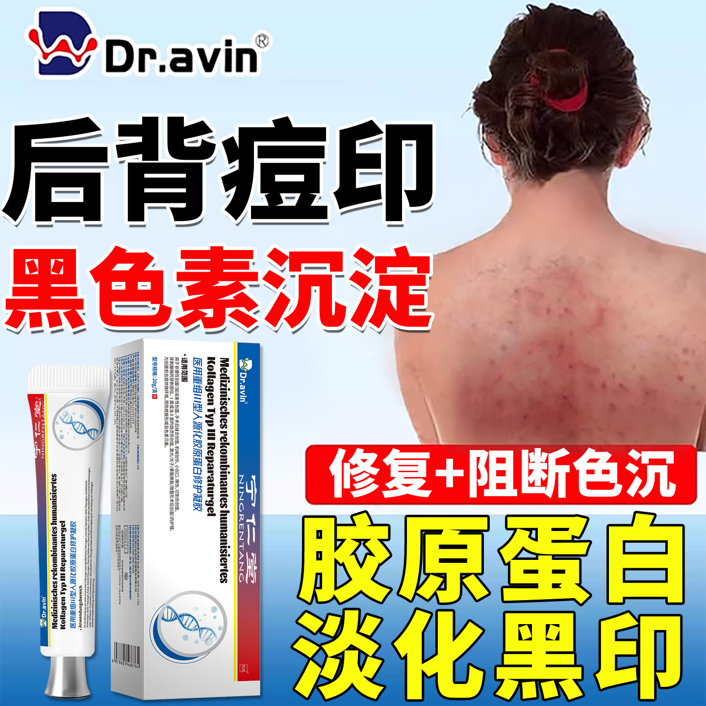 后背部痘印黑色素沉淀去除淡化修复专用膏祛痘印搭膏药贴医用型YU