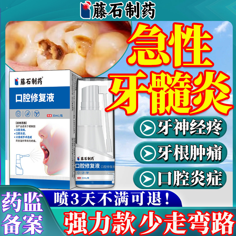 牙髓炎牙疼痛牙神经牙龈肿痛止疼喷剂漱口水医用专用可搭配牙膏BF