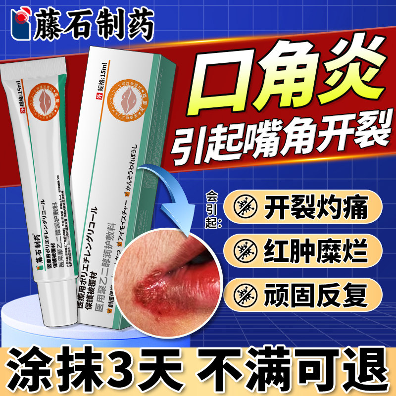 口角炎引起干裂烂嘴角开裂裂口干燥起皮嘴唇脱皮溃疡可搭药膏贴BF