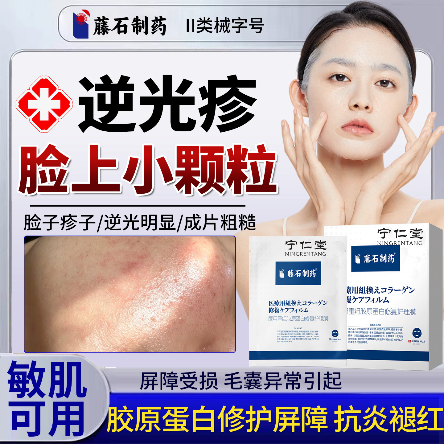 逆光疹修复脸上起小疙瘩小颗粒皮肤屏障去额头面部闭口粉刺儿童ON