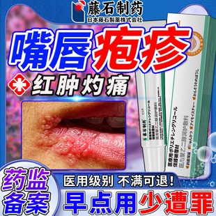 嘴唇单纯疱疹口唇嘴巴上火起泡烂嘴角水泡开裂药监备案膏BF