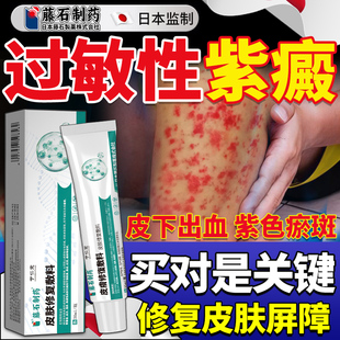 过敏性紫癜色素皮下出血红点瘀皮炎治疗特儿童的药监备案效中药BF