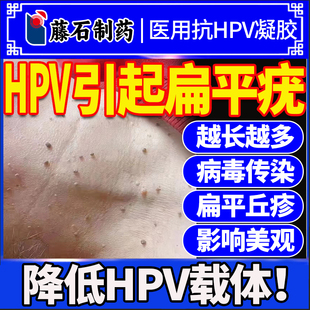 药监备案扁平疣除一抹hpv病去毒专用干扰素b2去凝胶手背灵上膏C6