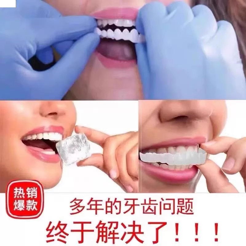 牙齿矫正器真牙套可吃饭神器临时美白缺门牙老人全口牙贴假牙套