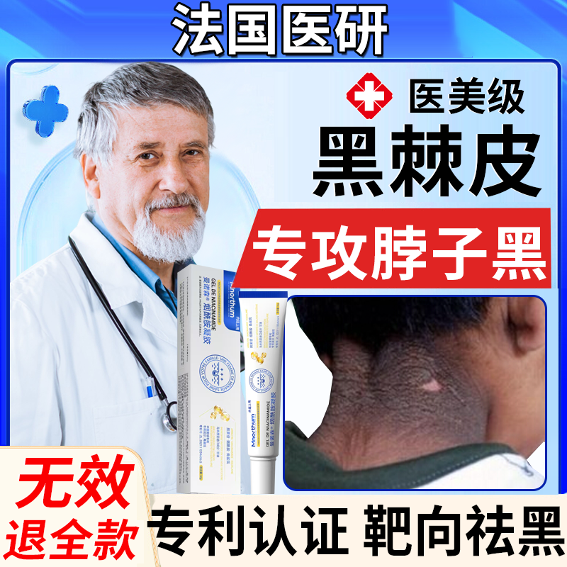 烟酰胺儿童成人去脖子黑棘皮药膏神器肥胖黑色素去除沉淀医用型EE