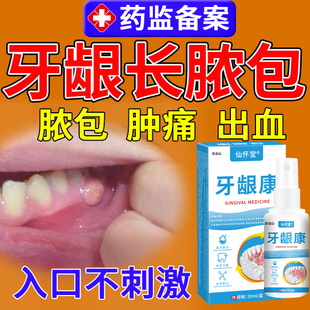牙龈脓包肿痛消炎专药用牙根发炎上火肿包牙周炎增生息肉喷雾剂W