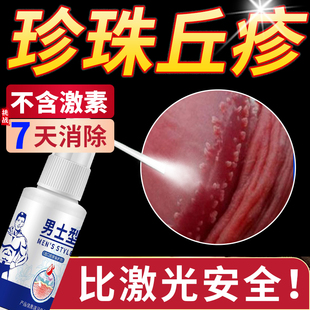 珍珠疹去除专用龟头炎症冠状沟系带旁丘疹颗粒皮脂腺异位症喷剂SD