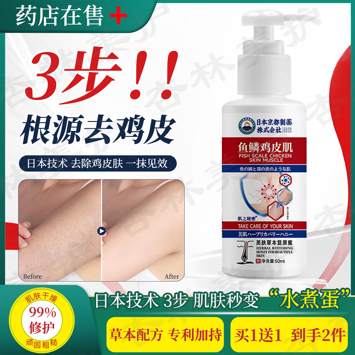 鱼鳞鸡皮肤去除草本身体乳沐浴露