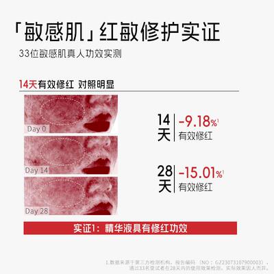 喜辽妥缓肤精华液舒缓保湿修护面部精华缓解敏感肌肤舒敏改善泛红