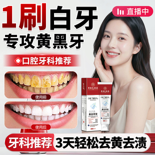 去牙渍牙垢黄牙膏美白去黄去口臭牙膏去烟渍溶解牙结石官方旗舰店
