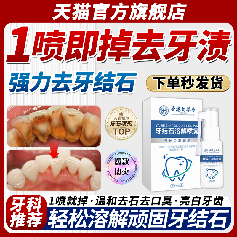 香港大药房去牙结石牙垢喷雾剂