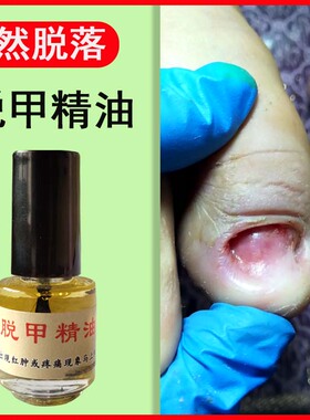 灰甲精油快速软甲液祛甲无痛祛坏甲灰甲杀菌指甲液玉指油脱甲精油