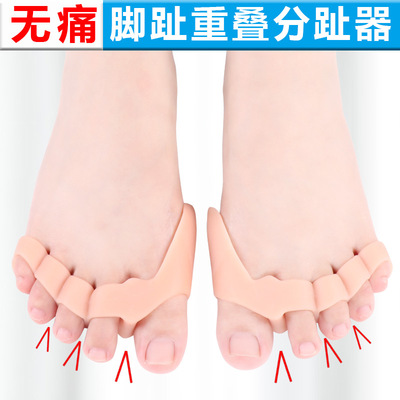 硅胶拇指外翻矫正器大脚骨纠正器