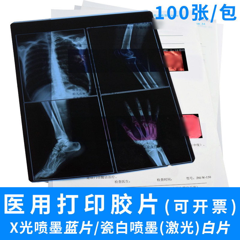 医用打印胶片干式医用胶片A4喷墨瓷白喷墨蓝片8*10X光片牙片口腔