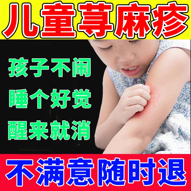 治宝宝婴幼儿去儿童丘疹性荨麻疹过敏止痒克星专用膏风团皮肤瘙痒