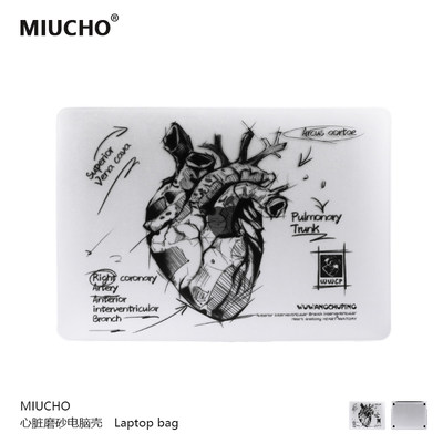 MIUCHO电脑保护硬壳简约原创设计