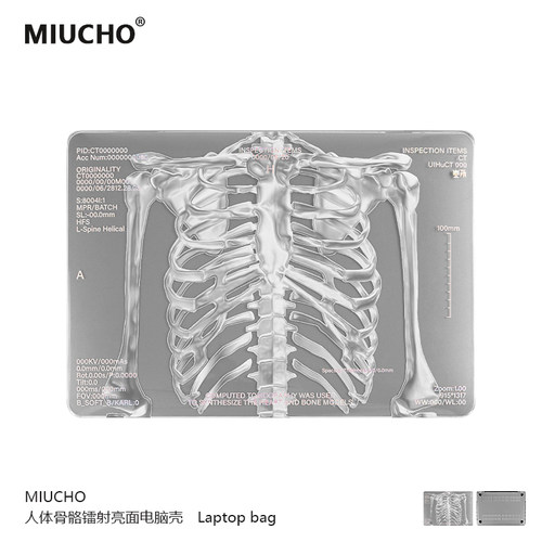 MIUCHO人体骨架macbook14电脑壳