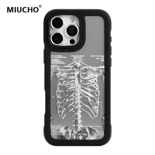 MIUCHO人体骨骼电镀苹果手机壳