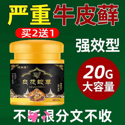 牛皮癣头皮癣销冠【1年内】10万+