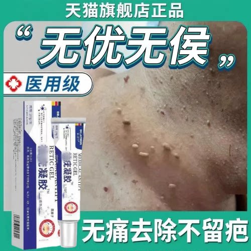 【触感粗糙突兀用它】德国去尤膏