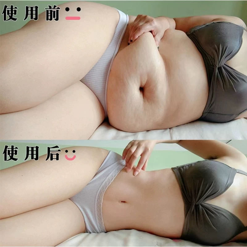 【爆款热销100万+】 肚脐贴懒人专用哺乳期可用男女通用 当天发货