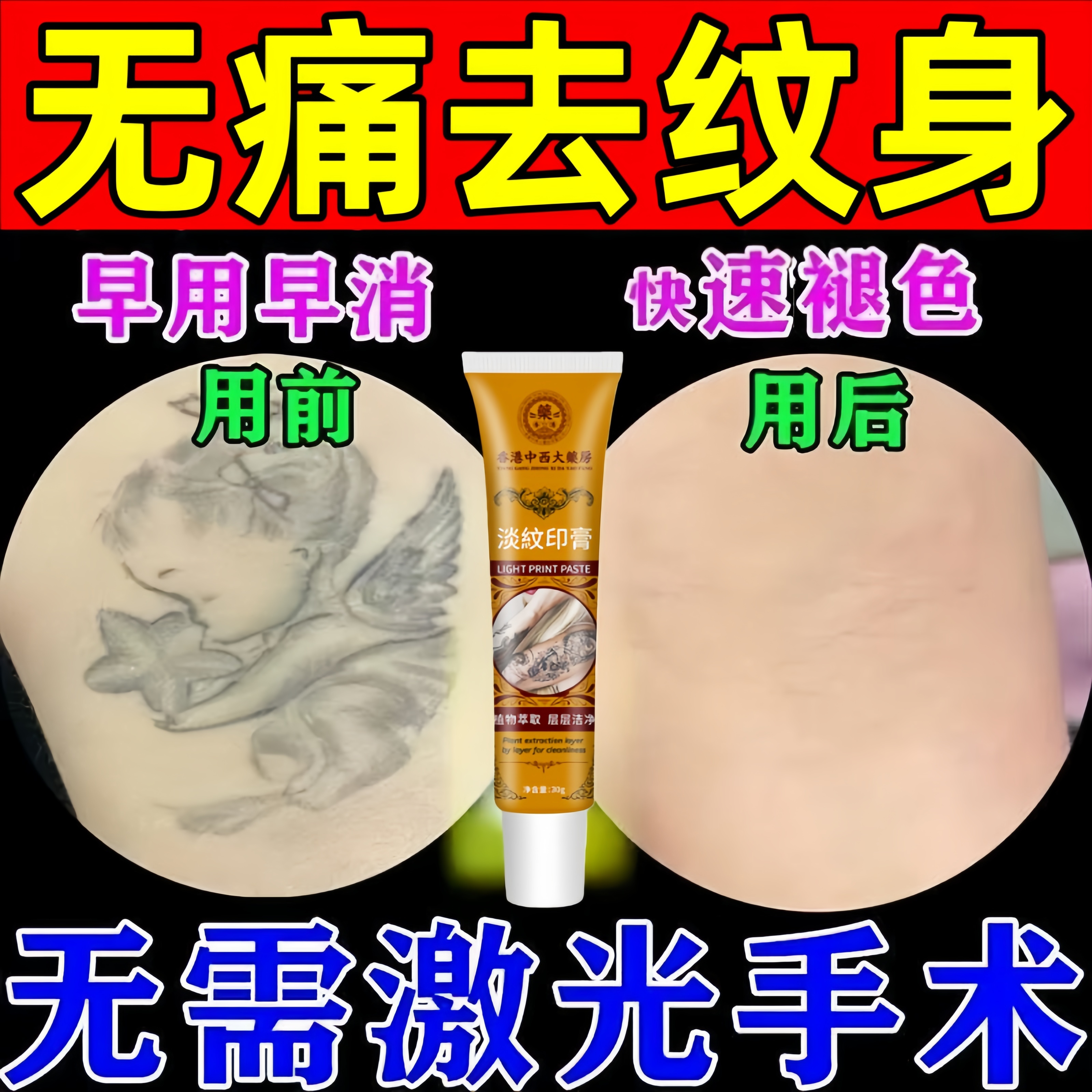 洗纹身专用药水无痛去除不留痕淡化刺青洗眉褪色剂消除神器修复膏