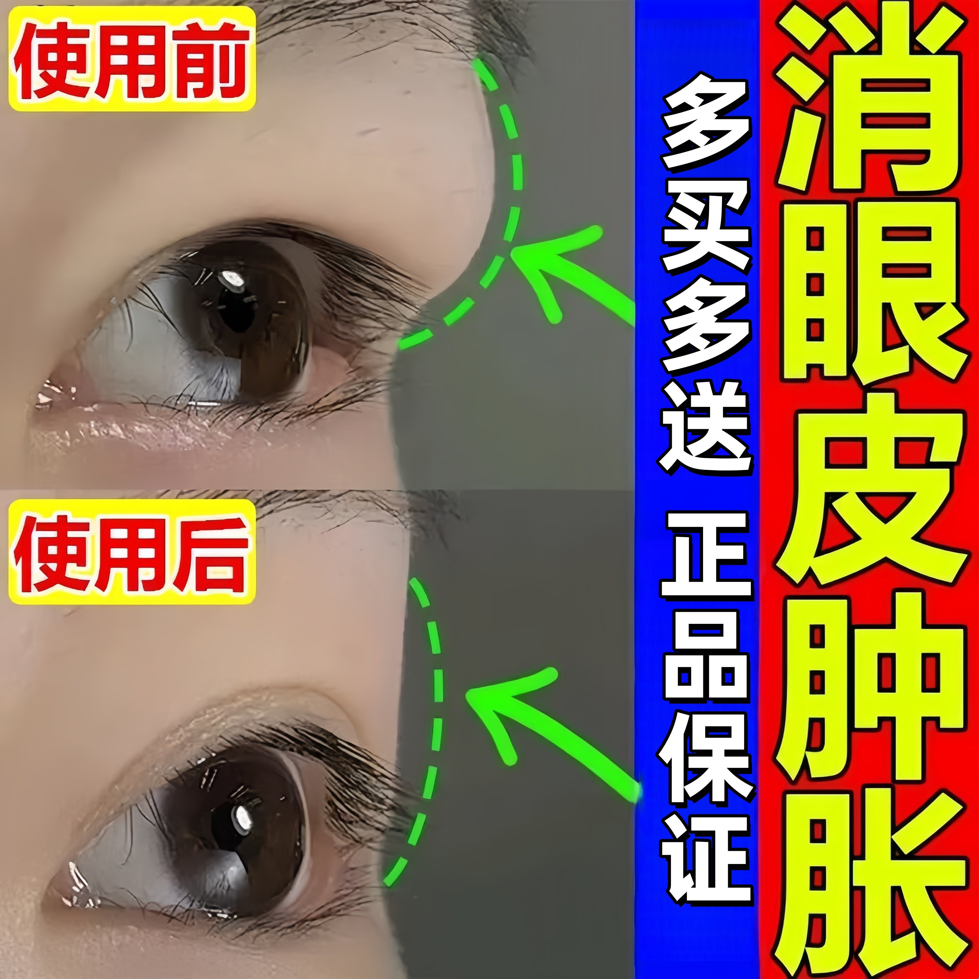 肿眼泡消外用去肿眼睛浮肿水肿熬夜眼皮肿胀上眼皮松弛专用膏眼贴