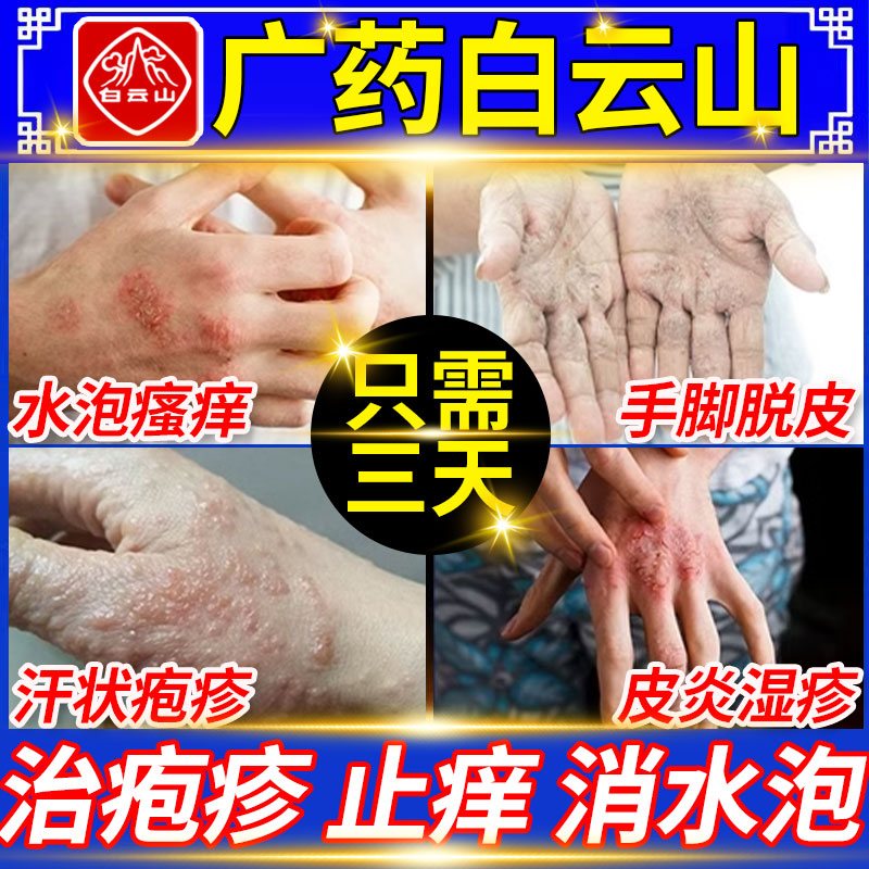 【白云山】复方醋酸地塞米松乳膏0.075%1%1%*10g*1支/盒