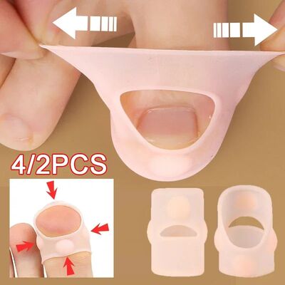 Silicone Ingrown Toenail Correction Tool Invisible Ingrown T