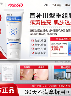 ubb蛋白膜fub蛋白膜复蓓生蛋白膜fbb蛋白膜bus蛋白膜bkk蛋白膜
