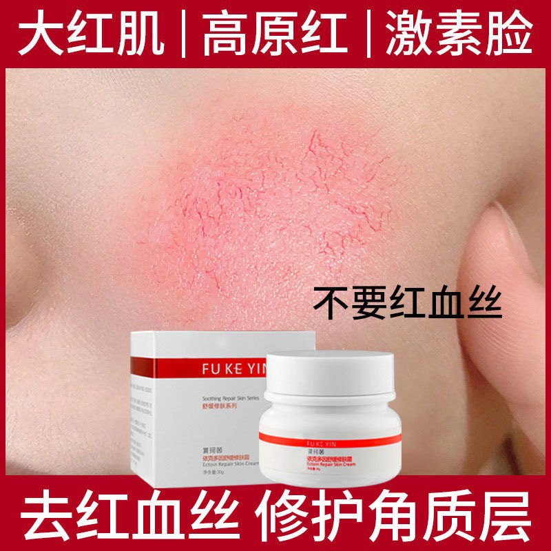 去红血丝修复角质层增厚敏感肌肤激素脸改善脸部泛红舒缓修护面霜