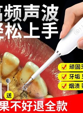 掏剔抠牙结石神器扣牙石清理刮牙垢器清除工具去除X器头专业声波