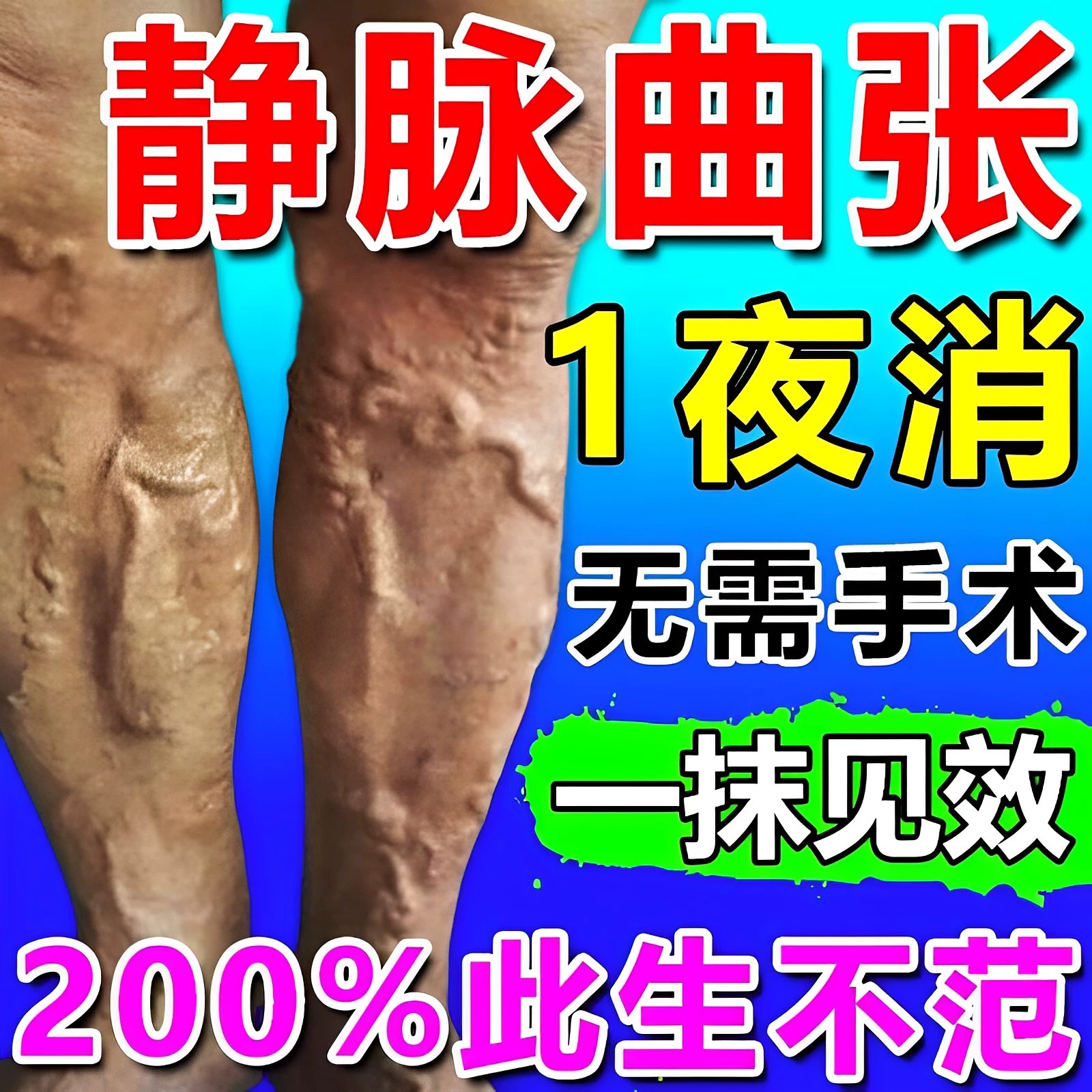 静脉曲张青筋凸起专用特效药