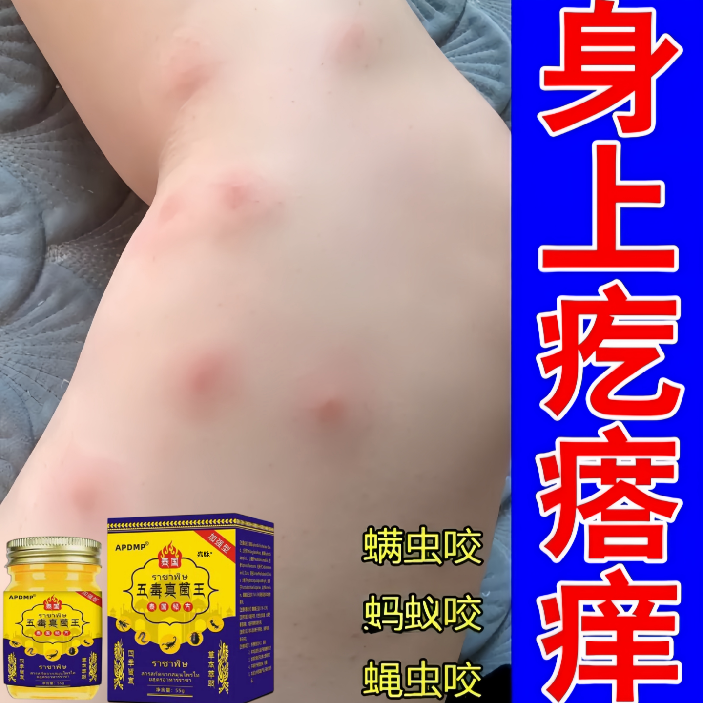 蚊虫叮咬跳蚤疥螨止痒膏